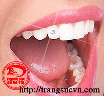 Kim cương gắn răng, gắn răng kim cương thiên nhiên, kim cuong gan rang